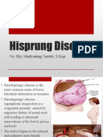 Hisprung Disease