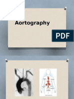 Aortography