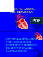 Acyanotic Heart Disease