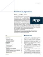 Xeroderma Pigmentoso: Diagnòstico y Tratamiento