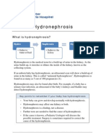 Hydronephrosis LW