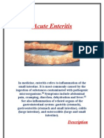 Acute Enteritis