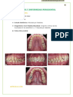 Monografia Gingivitis Periodoncia I Carlos Ccanto