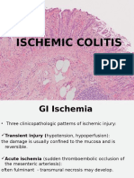 Ischemic Colitis