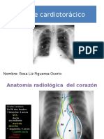 Diagnostic o Corazon