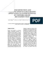 Edge Detection and Classification in X-Ray Images. Application To Interventional 3D Vertebra Shape Reconstruction