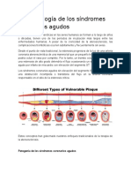 Fisiopatología de Los Síndromes Coronarios Agudos