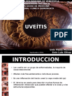 Uveitis