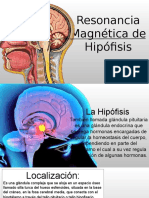 RM de Hipófisis PARA MI BFF