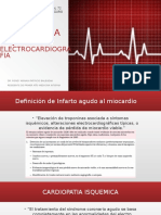 Cardiopatia Isquemica EKG