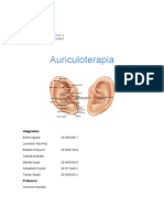 Auriculoterapia