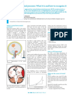 Raised Intracranial Pressure: What It Is and How To Recognise It