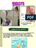 Apendicitis Aguda