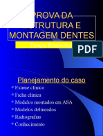 Prova de Estrutura e Montagem Dos Dentes