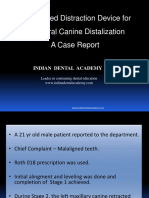 Unilateral Canine Distaliser Orthodontic Courses by Indian Dental Academy