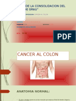 Cancer Al Colon Diapositivas