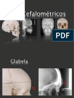 Cefalometría