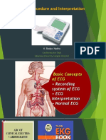 BCS Ekg