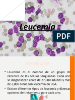 Leucemias y Linfomas en Pediatria