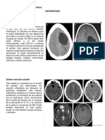 Neurocisticercosis 