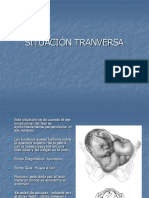 Situacion Transversa