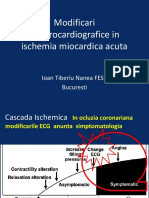 Modificari Electrocardiografice in Ischemia Miocardica Acuta - PPTX 2