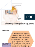 Encefalopatía Hipoxico - Isquemica