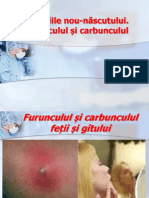 Furunculul Si Carbunculul