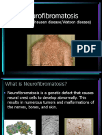 Neurofibromatosis