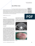 Primary Lymphoma of The Ovary