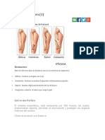 Tipos de Fractura