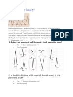 SVT With Aberrancy Versus VT