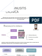 Rino Sinusitis Cronica