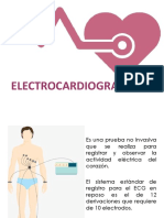 FELECTROCARDIOGRAMA