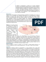 ADRENOLEUCODISTROFIA