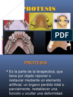 Diseodeprotesisparcialremovible 130602093458 Phpapp02