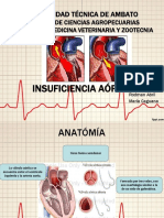 Insuficiencia Aortica