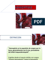 HEMOPTISIS