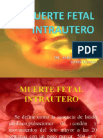 Muerte Fetal Intrautero