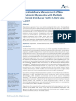 Interdisciplinary Management of Nonsyndromic Oligodontia With Multiple Retained Deciduous Teeth: A Rare Case Report