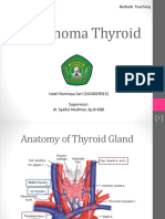 Carcinoma Thyroid: Izzati Nurmaya Sari (1610029013) Supervisor: Dr. Syaiful Mukhtar, SP.B-KBD