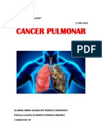 Cancer Pulmonar