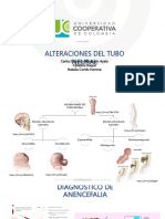 Encefalocele y Anencefalia 1