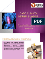 HNP Lumbar