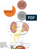 Síndrome Nefrótico