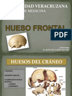 Presentacion de Hueso Frontal