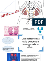 NEFRECTOMÍA