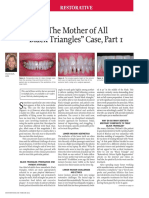 Treating The Mother of Black Triangles With Bioclear Veneers