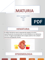 Hematuria 