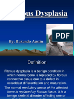 Fibrous Dysplasia PowerPoint Presentation